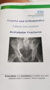 Acetabular Fractures